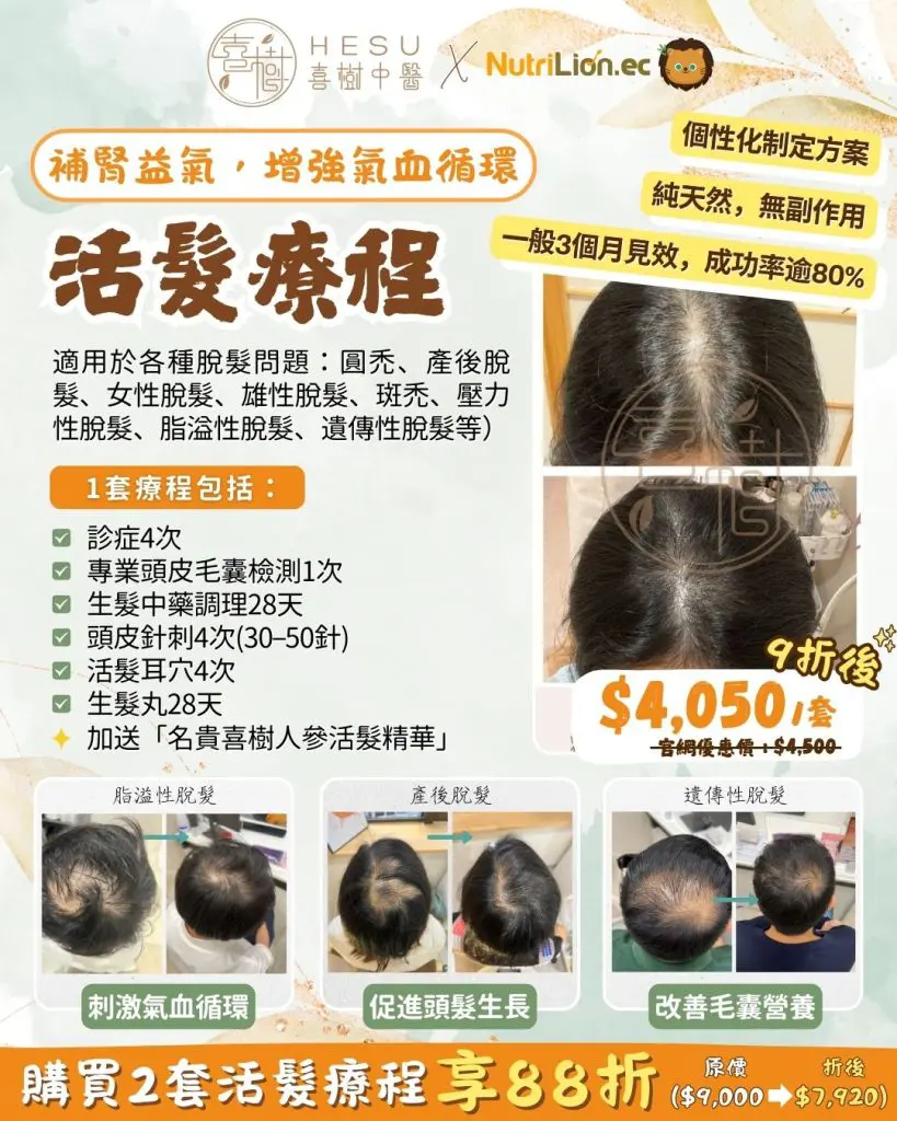 喜樹中醫優惠 - 活髮療程