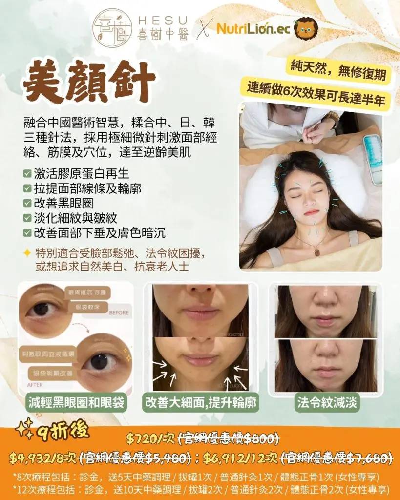 喜樹中醫優惠 - 美顏針