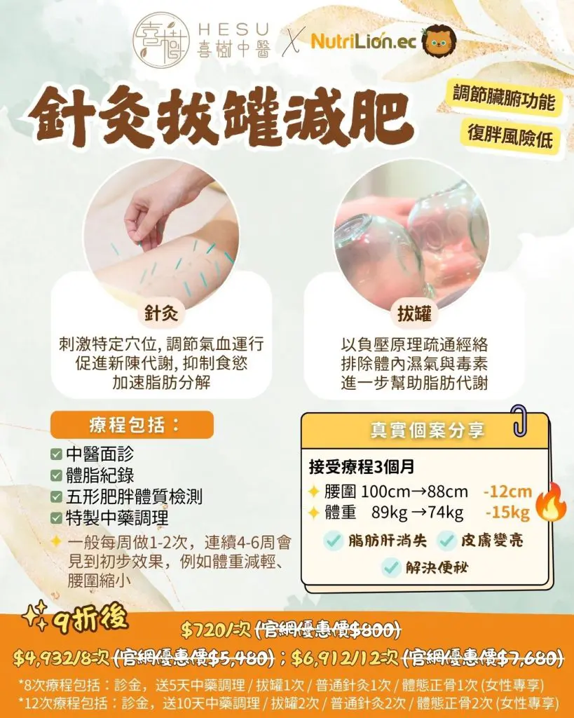 喜樹中醫優惠 - 針灸拔罐減肥療程 