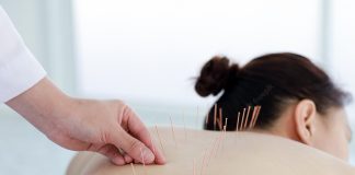 針灸原理是什麼?數清針灸好處,讓你不再怕針灸! 針灸好處