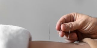 中醫埋線如何減肥?一文公開中醫埋線原理及副作用! 中醫埋線