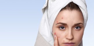 【暗瘡中醫】中醫暗瘡大拆解!公開中藥醫暗瘡方法! 暗瘡中醫