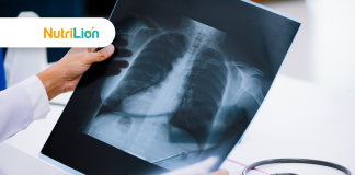 香港照肺X光價錢2023攻略(9月持續更新) 香港照肺X光價錢2023攻略(7月持續更新)