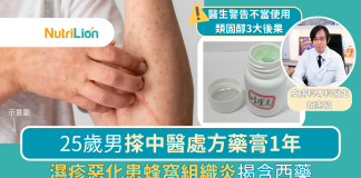 25歲男搽中醫處方藥膏1年 濕疹惡化揭含西藥|附皮膚科專科醫生分析 濕疹