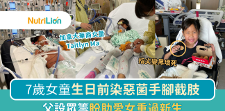 【A型鏈球菌感染】加拿大7歲華裔女童染惡菌截肢 父設眾籌盼助愛女重過新生 A型鏈球菌感染