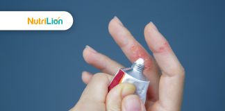 濕疹飲食指南:揭示8大濕疹飲食禁忌與4類改善濕疹皮膚的食物 濕疹飲食指南:揭示8大濕疹飲食禁忌與4類改善濕疹皮膚的食物