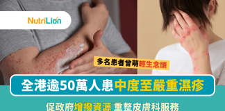 【世界濕疹日】全港逾50萬人患中度至嚴重濕疹 促政府增撥資源助患者 世界濕疹日 濕疹