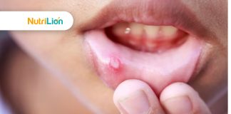 生痱滋一定關熱氣事?一文看清生痱滋原因及急救方法! 生痱滋