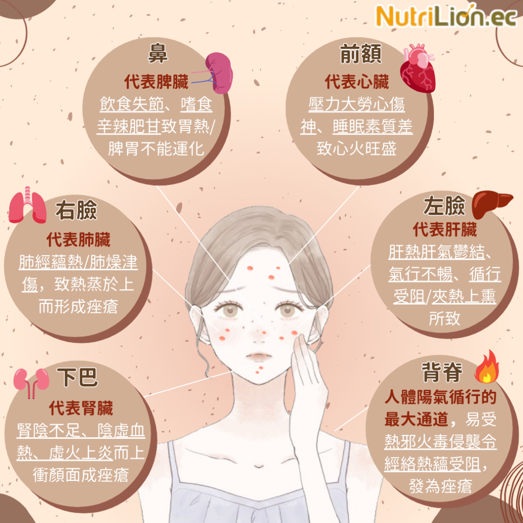 暗瘡護理｜6個暗瘡位置揭露身體隱患 附中醫拆解＋食療推介 - NutriLion 營養獅