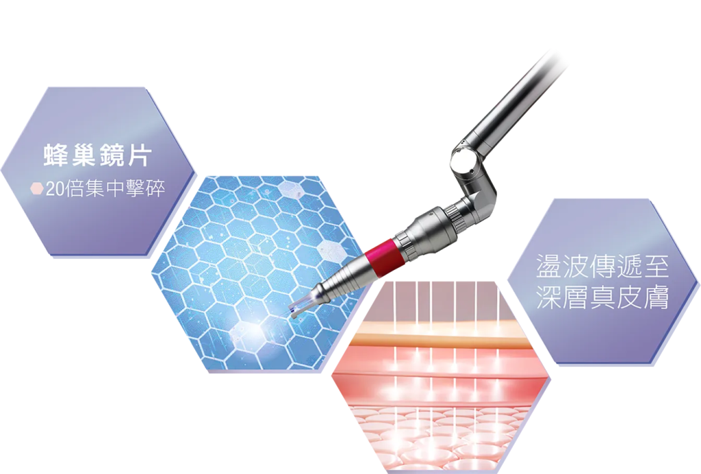 【皮秒】皮秒是什麼?了解Pico功效及最新皮秒價錢資訊