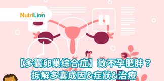 【多囊卵巢综合症】致不孕肥胖?專家拆解多囊卵巢症成因、症狀與治療