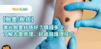 【脫墨/脫痣】激光脫墨好唔好?價錢多少?一文了解去墨原理、效果與護理方法 【脫墨/脫痣】激光脫墨好唔好?一文整合脫墨價錢