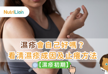 【濕疹初期】濕疹會自己好嗎?看清濕疹成因及止癢方法 【濕疹初期】濕疹會自己好嗎?看清濕疹成因及止癢方法