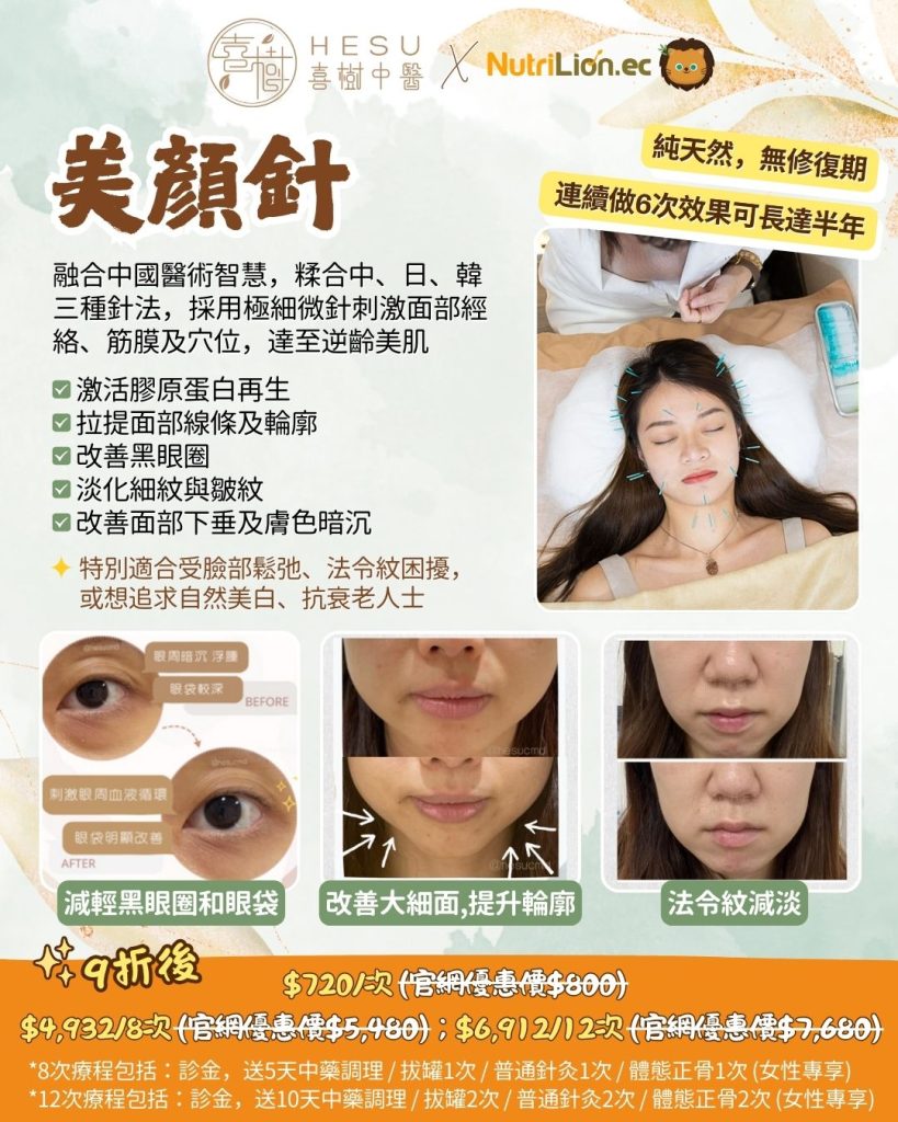 喜樹中醫優惠 - 美顏針