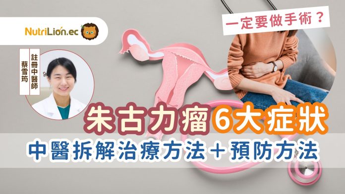 朱古力瘤症狀-中醫婦科-朱古力瘤治療 朱古力瘤症狀-中醫婦科-朱古力瘤治療