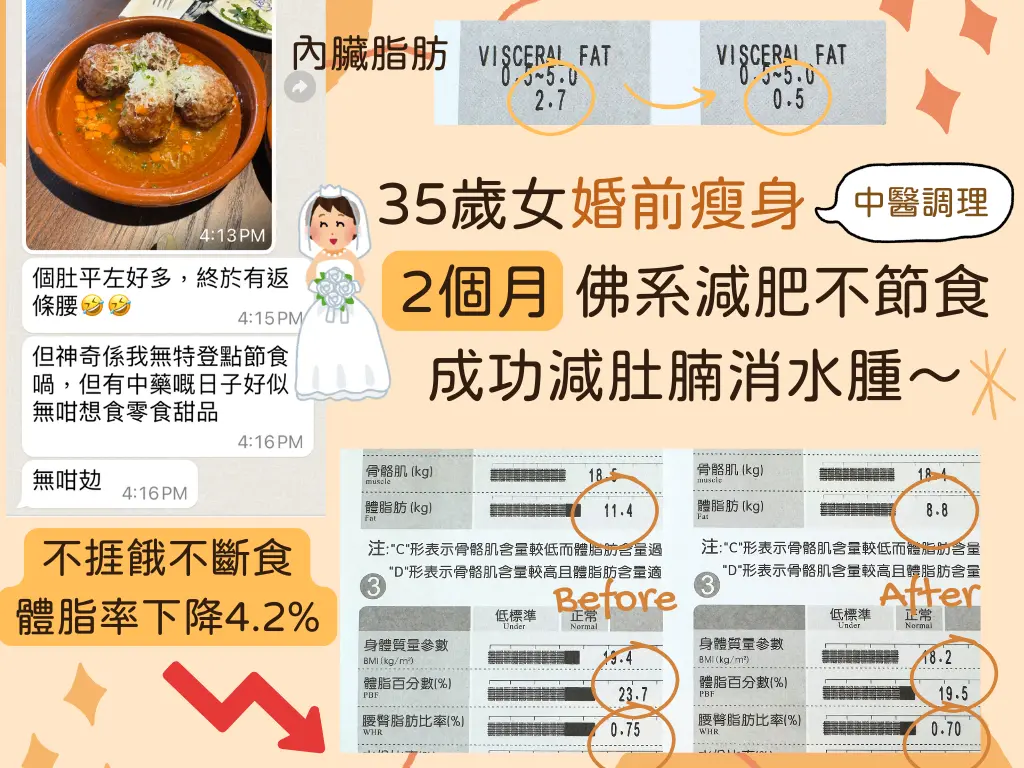 中醫減肥 - 個案二:32歲女婚前瘦身 中醫助減肚腩消水腫